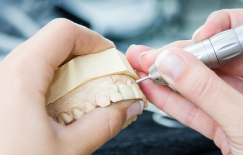 denture-repair