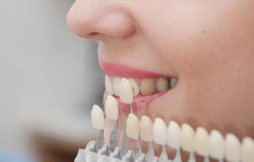 restorative-dentistry