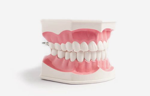 Dental Jaw Model